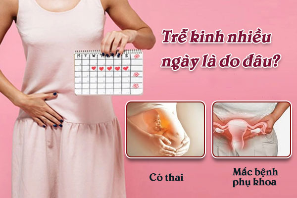 Tre-kinh-nhieu-ngay