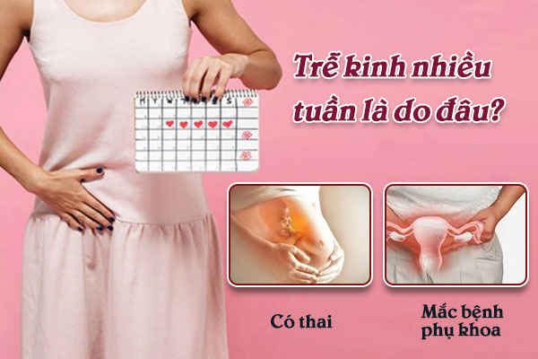 Tre-kinh-nhieu-tuan