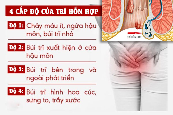 Tri-hon-hop