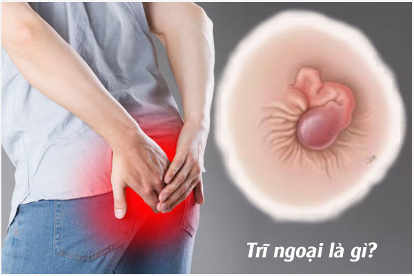 Tri-ngoai