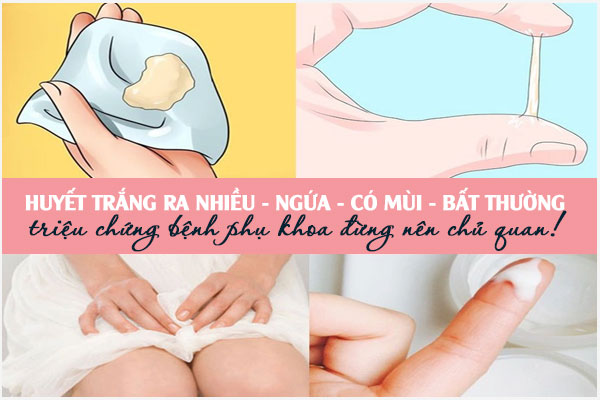 Âm đạo ra nhiều huyết trắng ngứa là bị gì? Cách khắc phục hiệu quả?