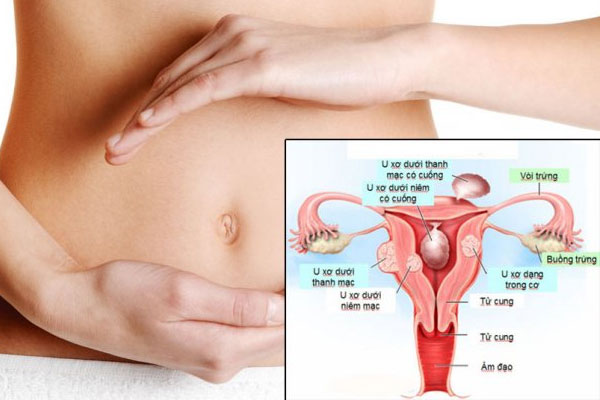 Đau bụng dưới rốn ở nữ cảnh báo bệnh lý nguy hiểm, không nên chủ quan!