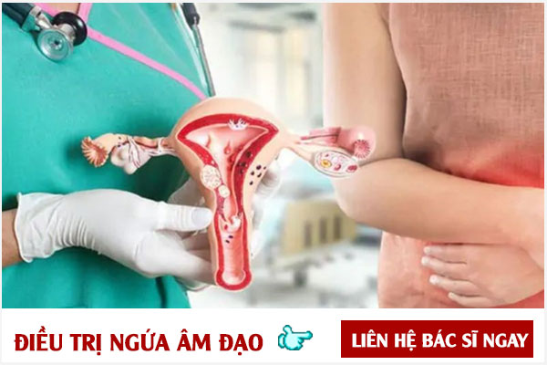 Cách điều trị ngứa âm đạo hiệu quả, không tái phát về sau