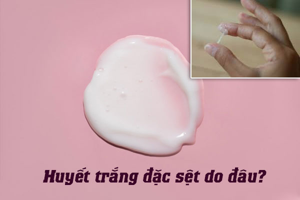 Huyết trắng đặc sệt là do đâu? Có nguy hiểm không?