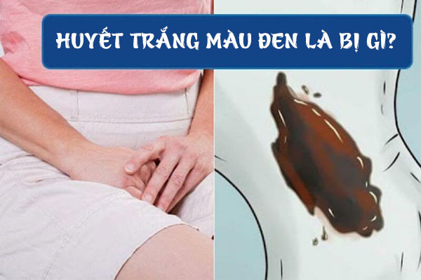 Huyết trắng màu đen dấu hiệu cảnh báo nguy hiểm phải biết