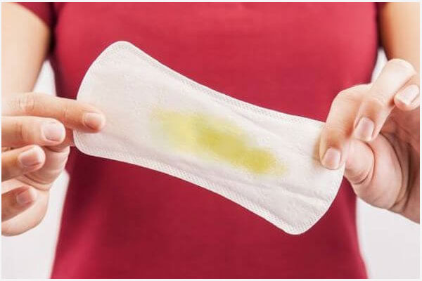 Ra dịch màu vàng ở vùng kín có sao không? Là dấu hiệu của bệnh gì?