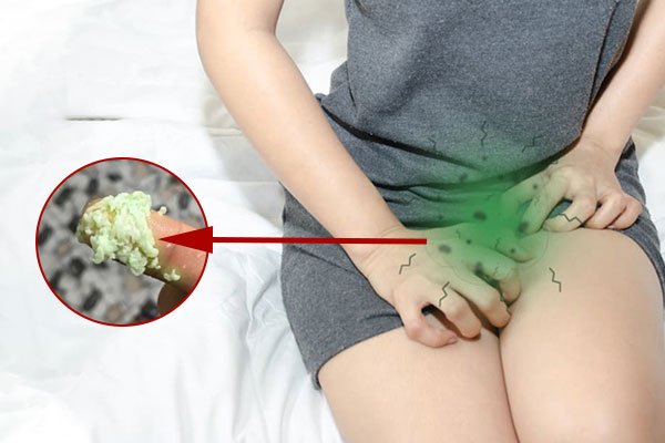 Huyết trắng màu xanh: Nguyên nhân và Cách khắc phục hiệu quả