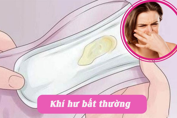 4 Cách điều trị bệnh khí hư bất thường hiệu quả không phải ai cũng biết
