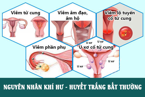 Khi-hu-bat-thuong-2