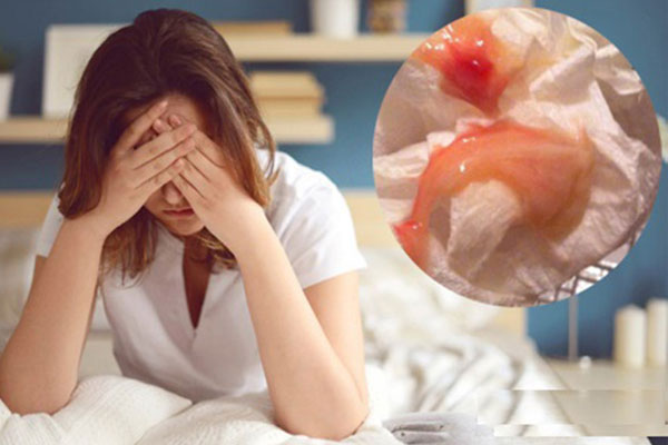 Ra khí hư màu đỏ là bị gì? Có nguy hiểm không?