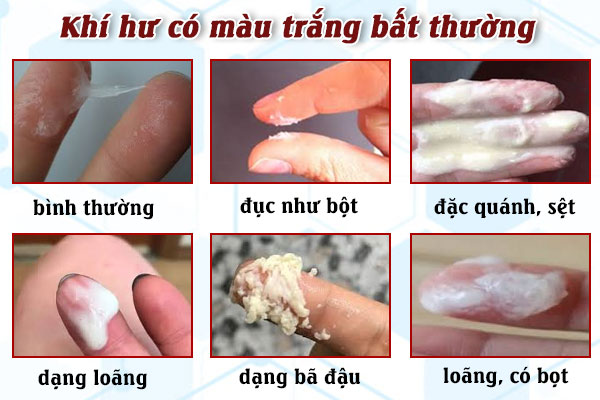 Khi-hu-mau-trang