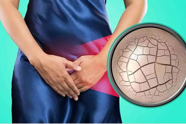 Nhận biết tình trạng bị khô âm đạo ở nữ giới và cách cải thiện hiệu quả