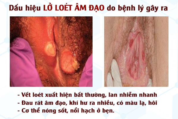 Lo-loet-am-dao