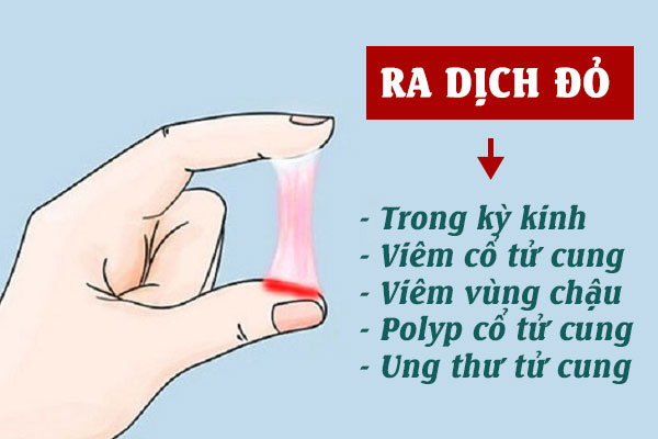 Ra dịch màu đỏ: Nguyên nhân và Cách khắc phục hiệu quả?