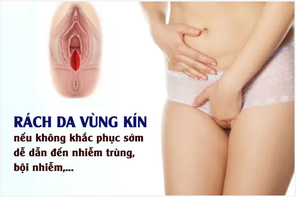 Nguyên nhân gây rách da vùng kín nữ và Cách khắc phục hiệu quả