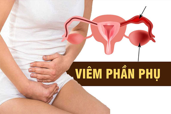 Viêm phần phụ ở nữ giới: Nguyên nhân, Dấu hiệu, Cách khắc phục hiệu quả