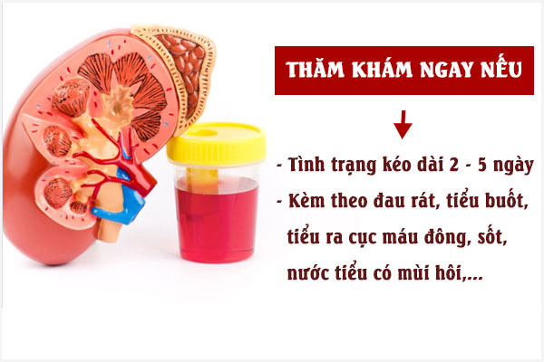 Di-tieu-bi-dau-bung-duoi