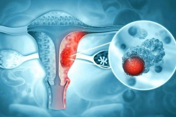 Lac-noi-mac-tu-cung-2