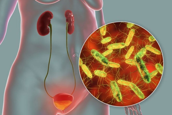 Nhiễm trùng nhiễm khuẩn đường tiểu nữ dễ gặp nhưng khó trị