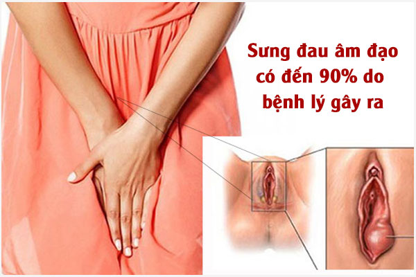 Đau sưng âm đạo sau khi quan hệ là bị gì?