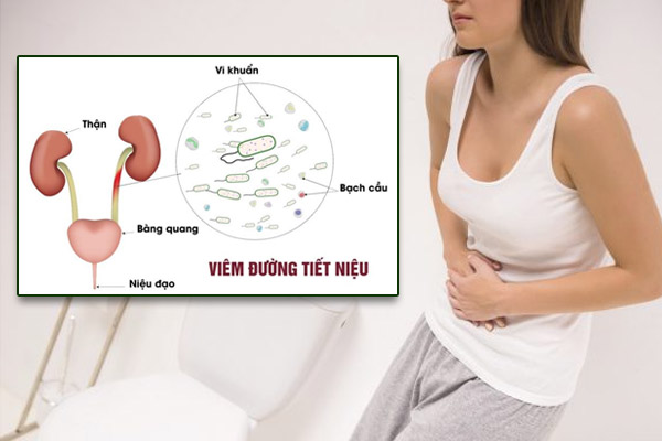 Viem-duong-tiet-nieu-nu-1