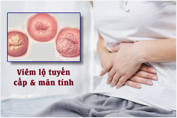 Viem-lo-tuyen-cap-va-man-tinh-3