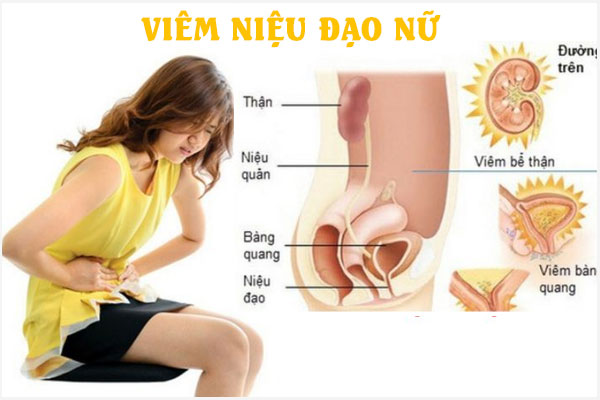 Viem-nieu-dao