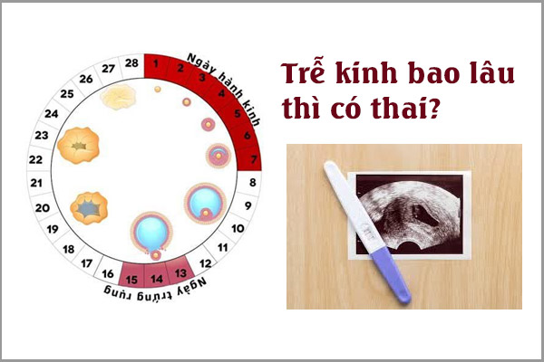 Tre-kinh
